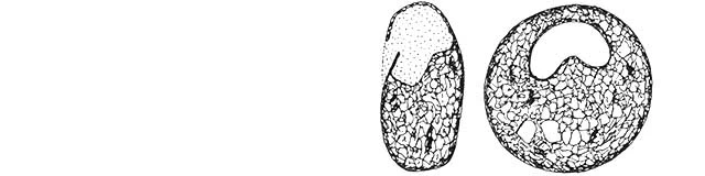 Plagiopyxis labiata